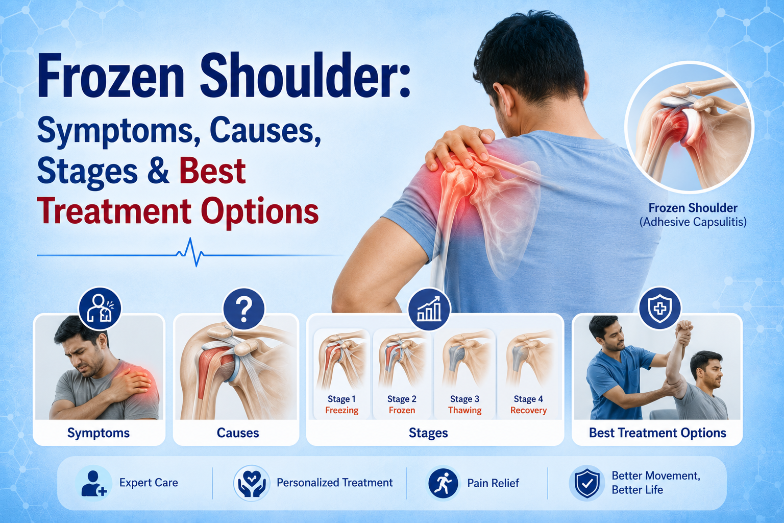 Frozen Shoulder symptoms